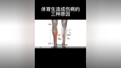 体育生常见的伤病,绝对策略计划研究_社交版40.12.0